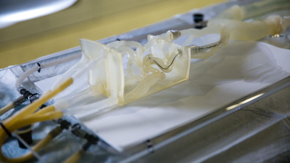 Translucent 3D printed vascular model used for medical device testing at the Jacobs Institute